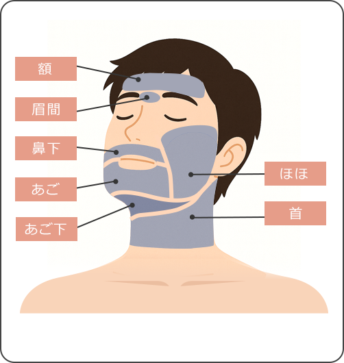 顔脱⽑（全顔）